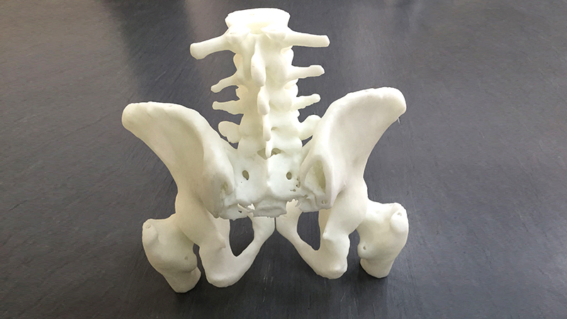 Orthopedics_Hip_Bone.jpg